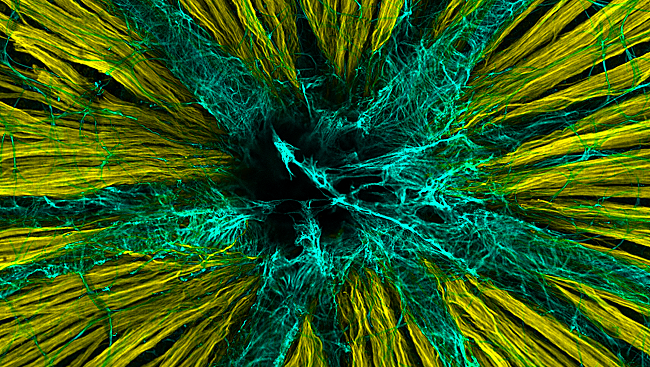 Axons of nerve cells (pictured in yellow) extend through a small opening in the back of the eye (in black) through the optic nerve to higher vision centers. The axons must penetrate another layer of cells known as astrocytes (in blue), which provide nutritional support to the retina.