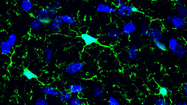 Microglia.