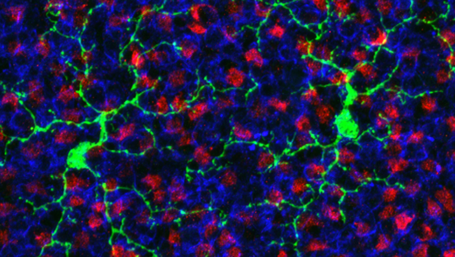This image of a mouse retina shows microglia (green) interacting with the synapses formed by axon terminals (red) and dendrites (blue).